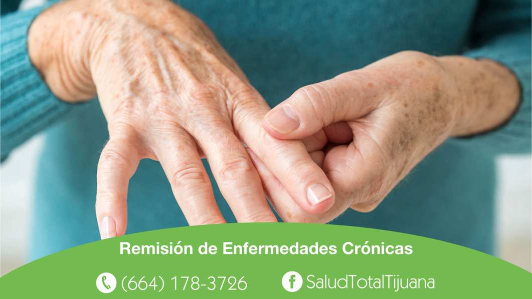 control de reumatismo en tijuana
